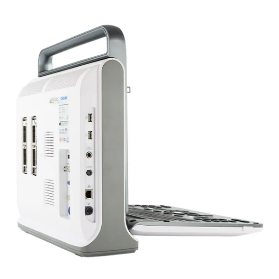 Transductores del ultrasonido Chison EBit 50 conectados al equipo durante procedimiento clínico
