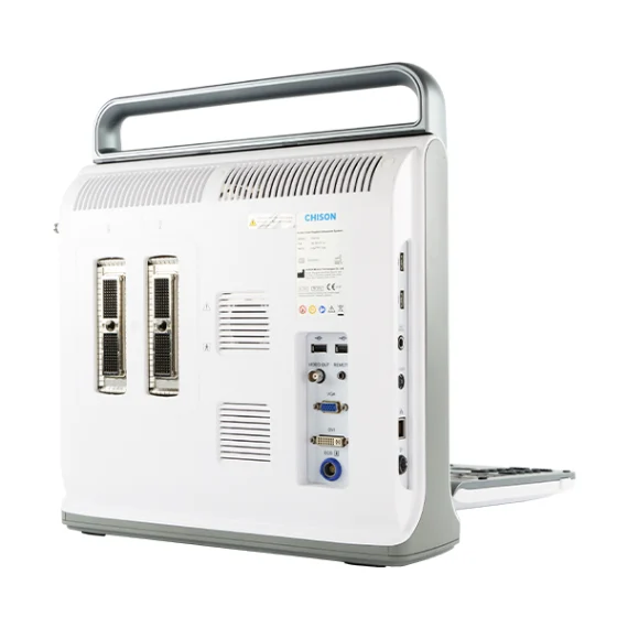 Ultrasonido Chison EBit 50 en consultorio médico equipado para diagnóstico general