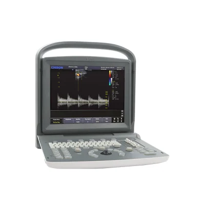 Vista frontal del ultrasonido Chison ECO2 mostrando interfaz en pantalla