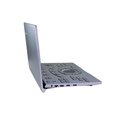 Pantalla del ultrasonido portátil Sonoair-60 con visualización de imágenes diagnósticas de alta resolución