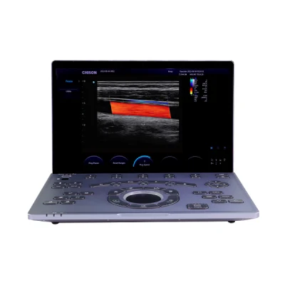 Vista general del ultrasonido portátil Sonoair-60 con diseño ligero y moderno