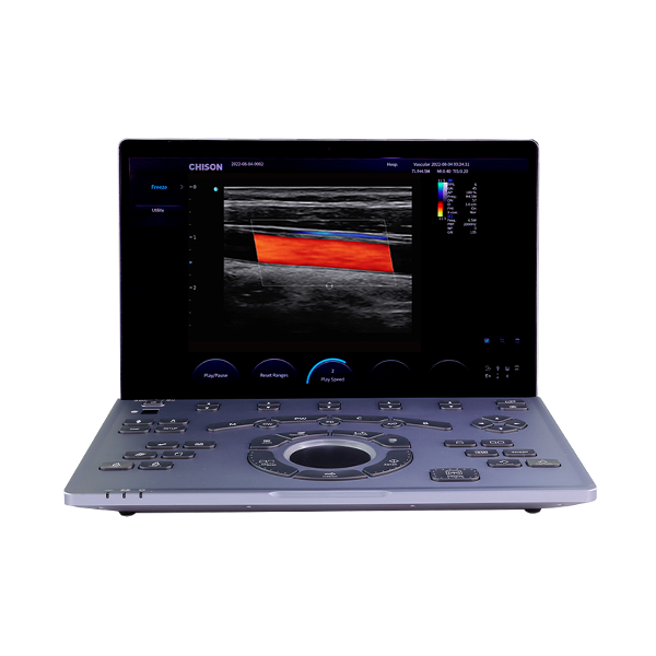 Vista general del ultrasonido portátil Sonoair-60 con diseño ligero y moderno
