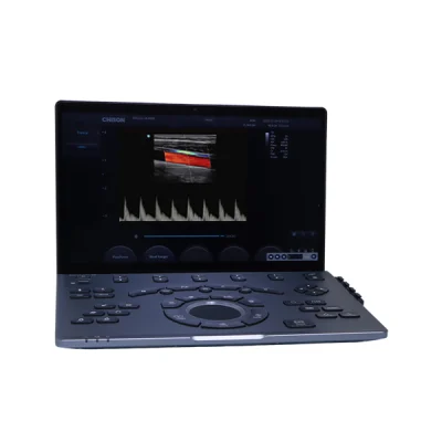 Vista general del ultrasonido portátil Sonoair-30 en modo diagnóstico