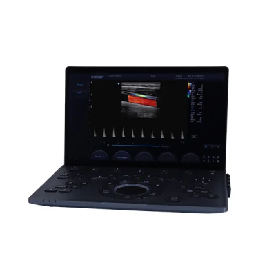 Panel de control táctil del ultrasonido portátil Sonoair-30 con interfaz intuitiva