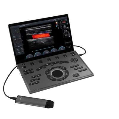 Ultrasonido Portátil Sonoair-30