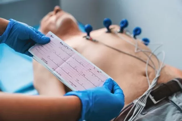 ELECTROCARDIOGRAMA